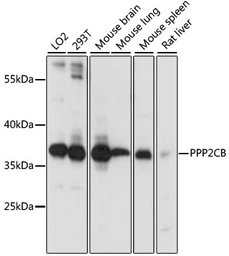 Anti-PP2A beta antibody used in Western Blot (WB). GTX33421