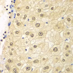 Anti-PSMD2 antibody used in IHC (Paraffin sections) (IHC-P). GTX33439