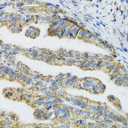 Anti-TXN2 antibody used in IHC (Paraffin sections) (IHC-P). GTX33563