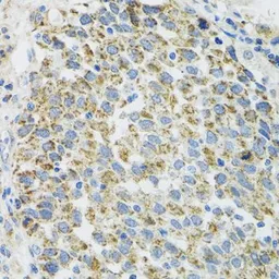 Anti-TXN2 antibody used in IHC (Paraffin sections) (IHC-P). GTX33563