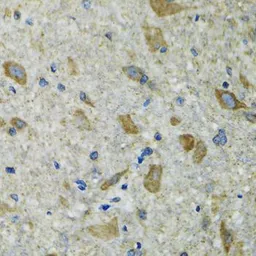 Anti-TXN2 antibody used in IHC (Paraffin sections) (IHC-P). GTX33563