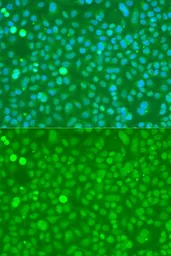 Anti-Ubiquitin C antibody used in Immunocytochemistry/ Immunofluorescence (ICC/IF). GTX33569