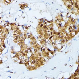 Anti-Ubiquitin C antibody used in IHC (Paraffin sections) (IHC-P). GTX33569