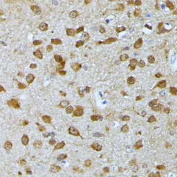 Anti-Ubiquitin C antibody used in IHC (Paraffin sections) (IHC-P). GTX33569