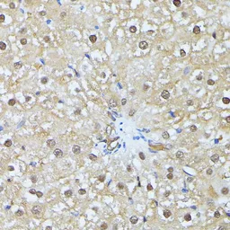 Anti-Ubiquitin C antibody used in IHC (Paraffin sections) (IHC-P). GTX33569