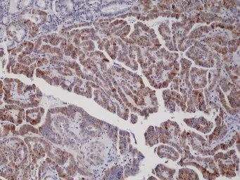 Anti-B-Raf (V600E Mutant Specific) antibody [RM8] used in IHC (Paraffin sections) (IHC-P). GTX33595