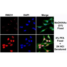 Anti-5-Methylcytosine / 5-mC antibody [RM231] used in Immunocytochemistry/ Immunofluorescence (ICC/IF). GTX33606