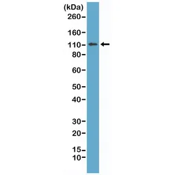 Anti-E-Cadherin antibody [RM244] used in Western Blot (WB). GTX33614