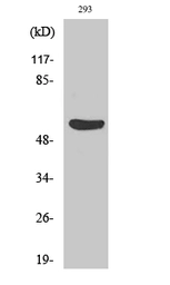 Anti-Gasdermin C antibody used in Western Blot (WB). GTX33979