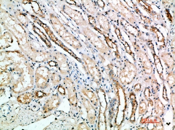 Anti-ART4 antibody used in IHC (Paraffin sections) (IHC-P). GTX34043