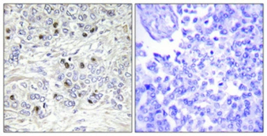 Anti-TEF4 antibody used in IHC (Paraffin sections) (IHC-P). GTX34260