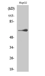 Anti-TESK2 antibody used in Western Blot (WB). GTX34261