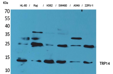 Anti-TRP14 antibody used in Western Blot (WB). GTX34287