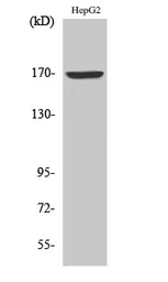 Anti-COL4A6 antibody used in Western Blot (WB). GTX34324