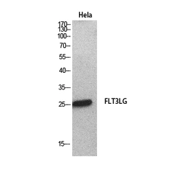 Anti-Flt3 Ligand antibody used in Western Blot (WB). GTX34380