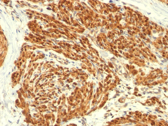 Anti-Calponin 1 antibody [CALP] used in IHC (Paraffin sections) (IHC-P). GTX34451