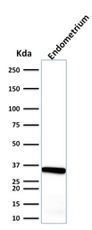 Anti-Calponin 1 antibody [CALP] used in Western Blot (WB). GTX34451