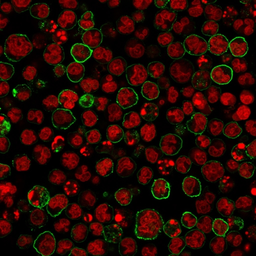 Anti-CD20 antibody [SPM618] used in Immunocytochemistry/ Immunofluorescence (ICC/IF). GTX34475