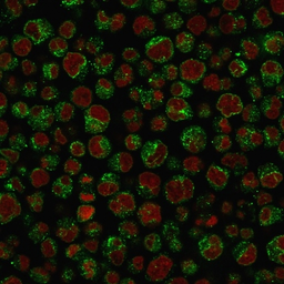 Anti-CD79a antibody [IGA/1688R] used in Immunocytochemistry/ Immunofluorescence (ICC/IF). GTX34562