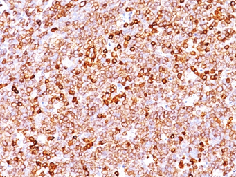 Anti-CD79a antibody [IGA/1688R] used in IHC (Paraffin sections) (IHC-P). GTX34562