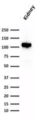 Anti-CDH16 antibody [CDH16/1532R] used in Western Blot (WB). GTX34583