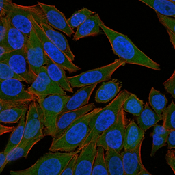 Anti-Fascin 1 antibody [FSCN1/418] used in Immunocytochemistry/ Immunofluorescence (ICC/IF). GTX34720