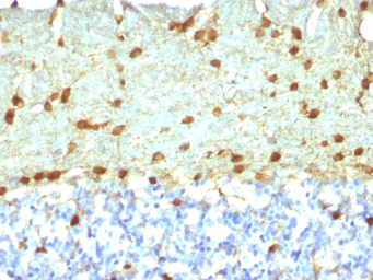 Anti-Fascin 1 antibody [FSCN1/418] used in IHC (Paraffin sections) (IHC-P). GTX34720