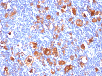 Anti-Fascin 1 antibody [FSCN1/418] used in IHC (Paraffin sections) (IHC-P). GTX34720