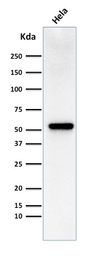 Anti-Fascin 1 antibody [FSCN1/418] used in Western Blot (WB). GTX34720