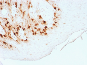 Anti-Melan A antibody [MLANA/1761R] used in IHC (Paraffin sections) (IHC-P). GTX34830