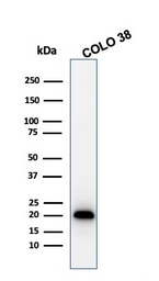 Anti-Melan A antibody [MLANA/1761R] used in Western Blot (WB). GTX34830