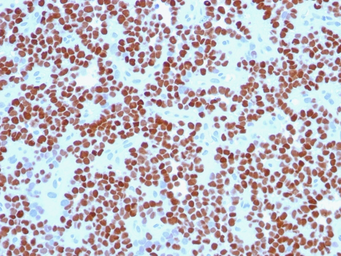 Anti-Nkx2.2 antibody [NX2/294] used in IHC (Paraffin sections) (IHC-P). GTX34908