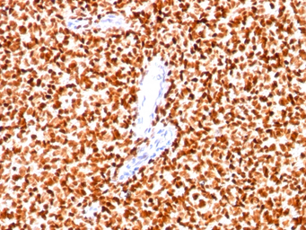 Anti-Nkx2.2 antibody [SPM564] used in IHC (Paraffin sections) (IHC-P). GTX34909