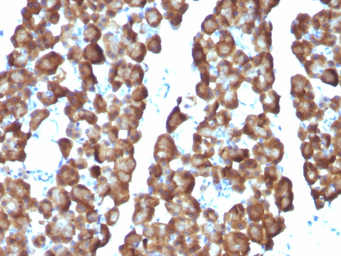 Anti-ODC antibody [ODC1/487] used in IHC (Paraffin sections) (IHC-P). GTX34922