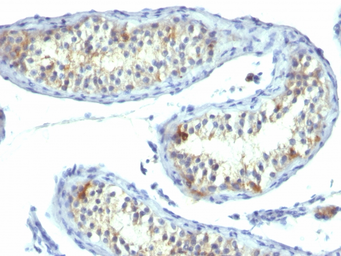 Anti-Prolactin Receptor antibody [B6.2] used in IHC (Paraffin sections) (IHC-P). GTX34984