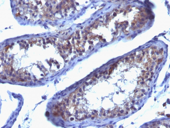 Anti-Prolactin Receptor antibody [SPM213] used in IHC (Paraffin sections) (IHC-P). GTX34985