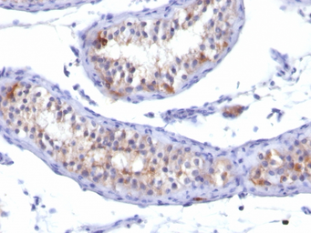 Anti-Prolactin Receptor antibody [PRLR742] used in IHC (Paraffin sections) (IHC-P). GTX34986