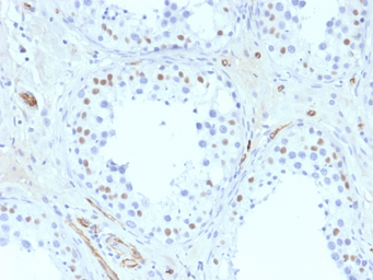 Anti-Wilms Tumor 1 antibody [6F-H2] used in IHC (Paraffin sections) (IHC-P). GTX35172