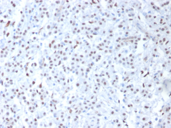 Anti-Wilms Tumor 1 antibody [6F-H2] used in IHC (Paraffin sections) (IHC-P). GTX35172