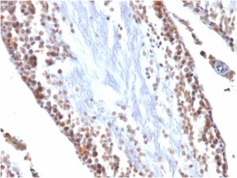 Anti-Wilms Tumor 1 antibody [WT1/857] used in IHC (Paraffin sections) (IHC-P). GTX35174