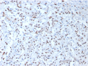 Anti-Wilms Tumor 1 antibody [WT1/857] used in IHC (Paraffin sections) (IHC-P). GTX35174