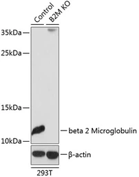 Anti-beta 2 Microglobulin antibody used in Western Blot (WB). GTX35209