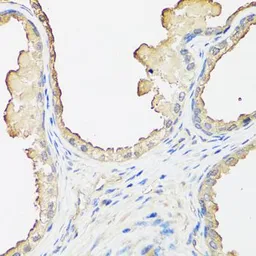 Anti-beta 2 Microglobulin antibody used in IHC (Paraffin sections) (IHC-P). GTX35209