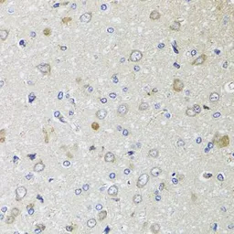 Anti-beta 2 Microglobulin antibody used in IHC (Paraffin sections) (IHC-P). GTX35209