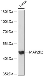 Anti-MEK2 antibody used in Western Blot (WB). GTX35223