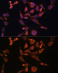 Anti-MEK2 antibody used in Immunocytochemistry/ Immunofluorescence (ICC/IF). GTX35223