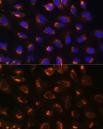 Anti-MEK2 antibody used in Immunocytochemistry/ Immunofluorescence (ICC/IF). GTX35223