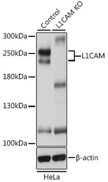 Anti-L1CAM antibody used in Western Blot (WB). GTX35239