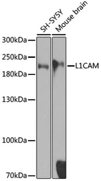 Anti-L1CAM antibody used in Western Blot (WB). GTX35239