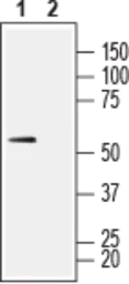 Anti-MCT1 antibody used in IHC (Free Floating) (IHC (Free Floating)). GTX35258